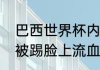 巴西世界杯内马尔被谁伤了（内马尔被踢脸上流血哪一场）