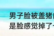 男子脸被盖猪肉印章终于洗掉了 “但是脸感觉掉了一层皮，非常痛。”