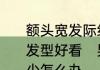 额头宽发际线高头发比较少男生什么发型好看　男士额头两侧头发越来越少怎么办